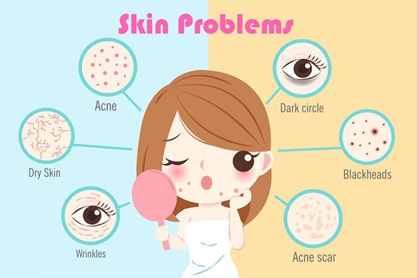 Skin Flaws over Face and their Solutions